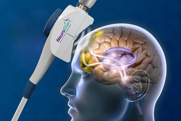 NeuroStar treatment coil beside an illustration of the brain areas it stimulates
